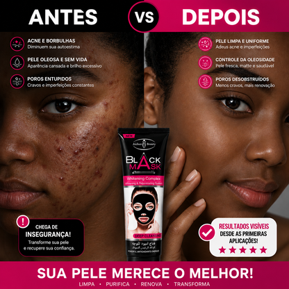AICLAR DETÓX DA BLACK MASK - MÁSCARA FACIAL
